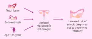 Cost Breakdown: What You'll Actually Pay for Assisted Reproductive Technology Near Me